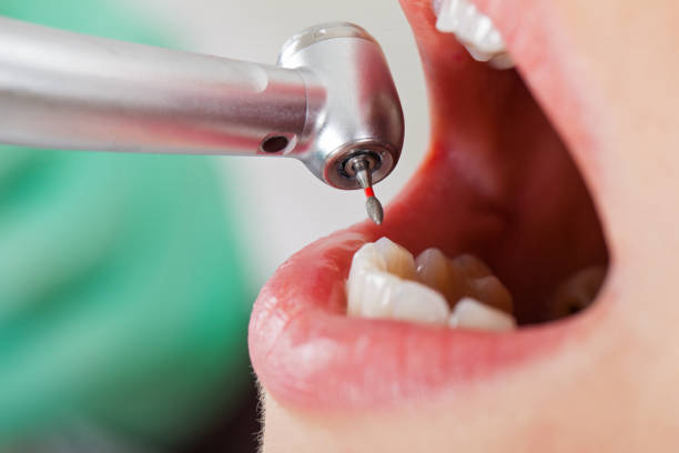 Best Orthodontic Emergency Dentist in Lawrence, IN